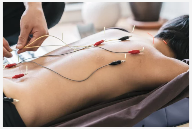 person receiving electrical acupuncture on their back